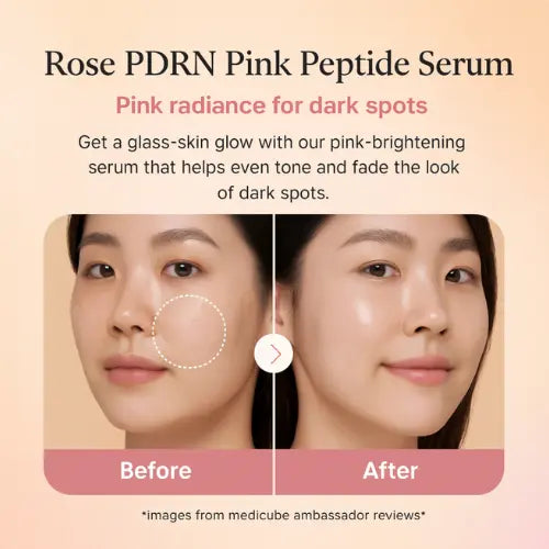 [medicube] PDRN Pink Peptide Serum - Peptide, Niacinamide, Hydrating & Firming (1.01 Fl Oz, 30ml) The Korean Style