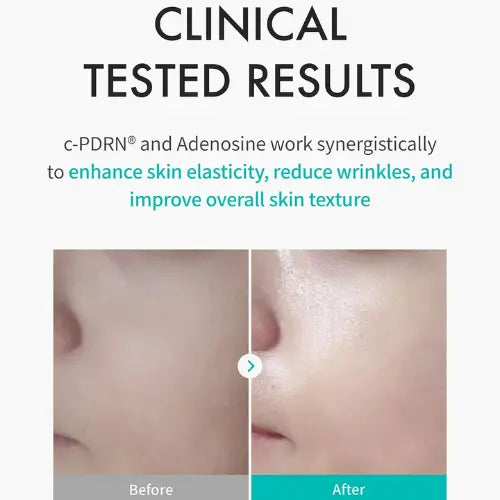 Rejuran Turnover Mask 5 Sheets | c-PDRN 40 ml per mask - The Korean Style