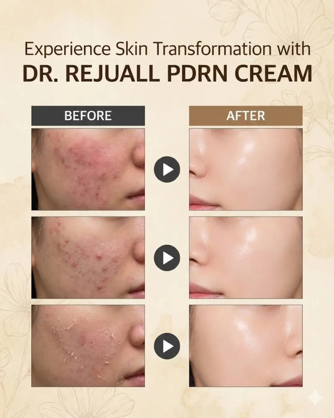 Dr. Reju-All Advanced PDRN Rejuvenating Cream — rejuall pdrn cream | 30ml The Korean Style